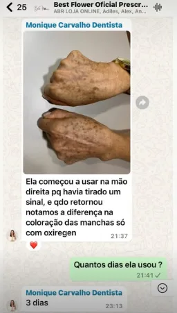 Depoimento manchas mão OX REGEN